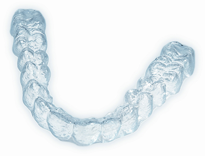Invisalign Aligner